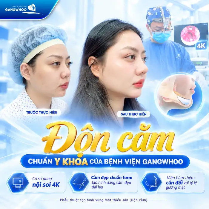 Độn Cằm Có Được Vĩnh Viễn Không? Giải Đáp Chi Tiết Từ Chuyên Gia