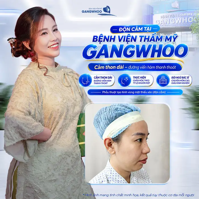 Độn Cằm Có Gây Mê Không? Giải Đáp Từ Bác Sĩ Chuyên Khoa