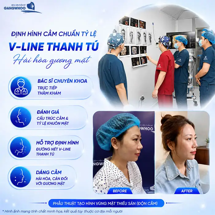 Độn Cằm Có Gây Mê Không? Giải Đáp Từ Bác Sĩ Chuyên Khoa