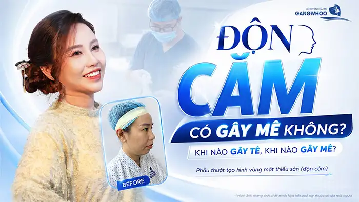 Độn Cằm Có Gây Mê Không? Giải Đáp Từ Bác Sĩ Chuyên Khoa