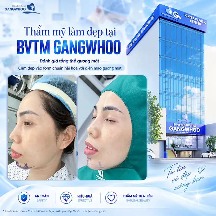 Độn Cằm Rồi Có Tiêm Filler Được Không? Bác Sĩ Giải Đáp