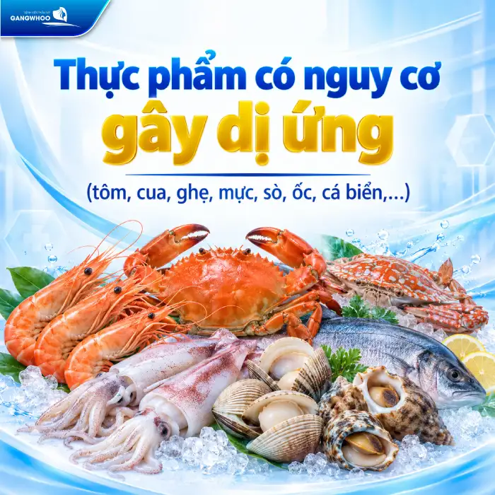 Độn Cằm Kiêng Ăn Gì? Top 7 Thực Phẩm Cần Tránh