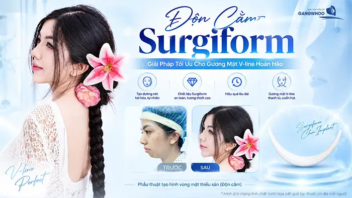 Độn Cằm Surgiform: Giải Pháp Tối Ưu Cho Gương Mặt V-line Hoàn Hảo