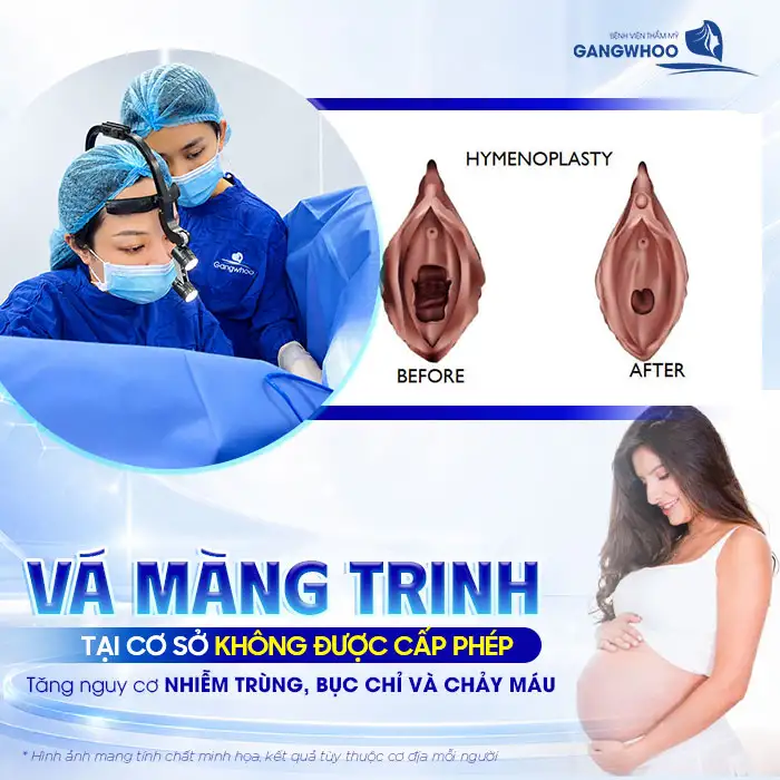 Vá Màng Trinh Có Nguy Hiểm Không? Bác Sĩ Bệnh Viện Gangwhoo Chia Sẻ