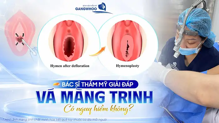 Vá Màng Trinh Có Nguy Hiểm Không? Bác Sĩ Bệnh Viện Gangwhoo Chia Sẻ
