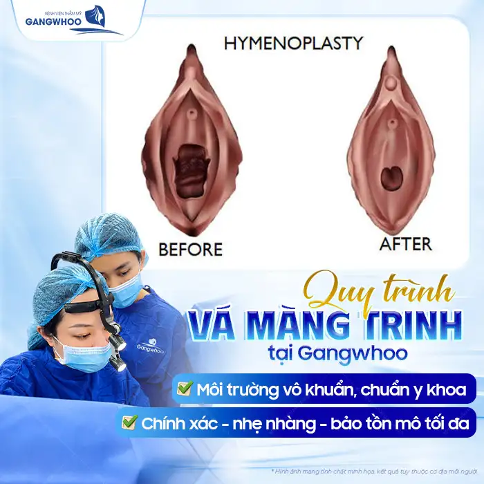 Vá Màng Trinh Được Không Khi Đã Quan Hệ Nhiều Lần? Giải Đáp Từ Bác Sĩ