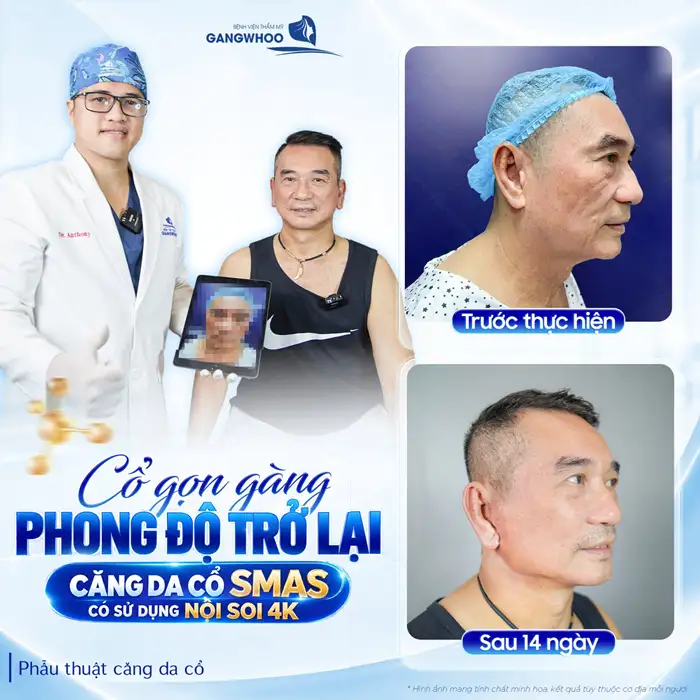 Căng Da Cổ Giá Bao Nhiêu? Bảng Giá Mới Nhất & Yếu Tố Ảnh Hưởng