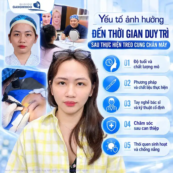 Nâng Cung Chân Mày Giữ Được Bao Lâu? Giải Đáp Chuyên Sâu Từ Góc Nhìn Y Khoa