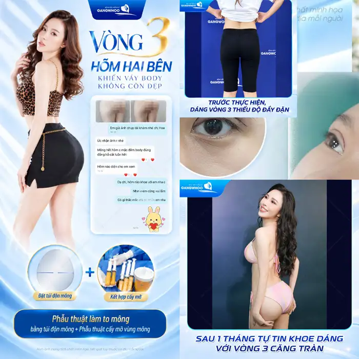 Nâng Mông Có Đau Không? Giải Đáp Chi Tiết Từ Bác Sĩ Tạo Hình