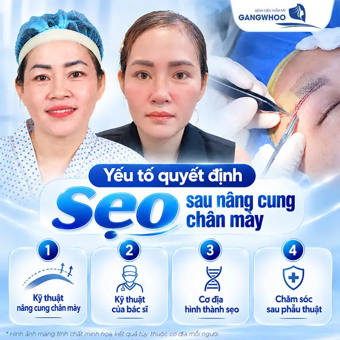 Nâng Cung Chân Mày Có Để Lại Sẹo Không? Góc Nhìn Chuyên Khoa Thẩm Mỹ