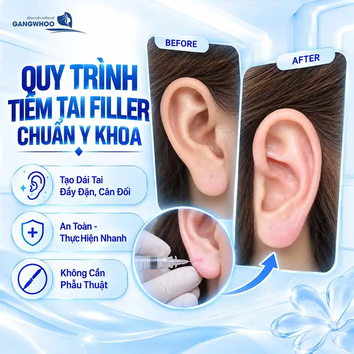 Tiêm Tai Tài Lộc Có Đau Không? Giải Đáp Từ Góc Độ Y Khoa