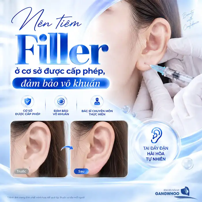 Tiêm Tai Tài Lộc Có Đau Không? Giải Đáp Từ Góc Độ Y Khoa