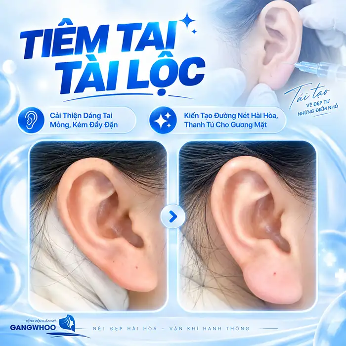 Tiêm Tai Tài Lộc Giá Bao Nhiêu? Có Nên Tiêm Tai Giá Rẻ
