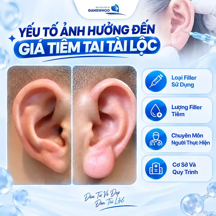 Tiêm Tai Tài Lộc Giá Bao Nhiêu? Có Nên Tiêm Tai Giá Rẻ