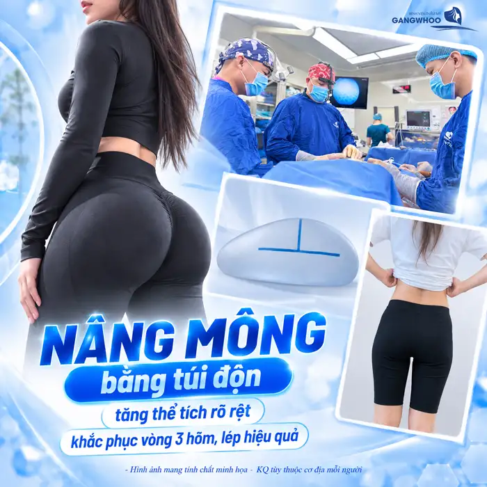 Túi Nâng Mông Là Gì? Các Loại, Độ An Toàn Và Những Điều Cần Biết