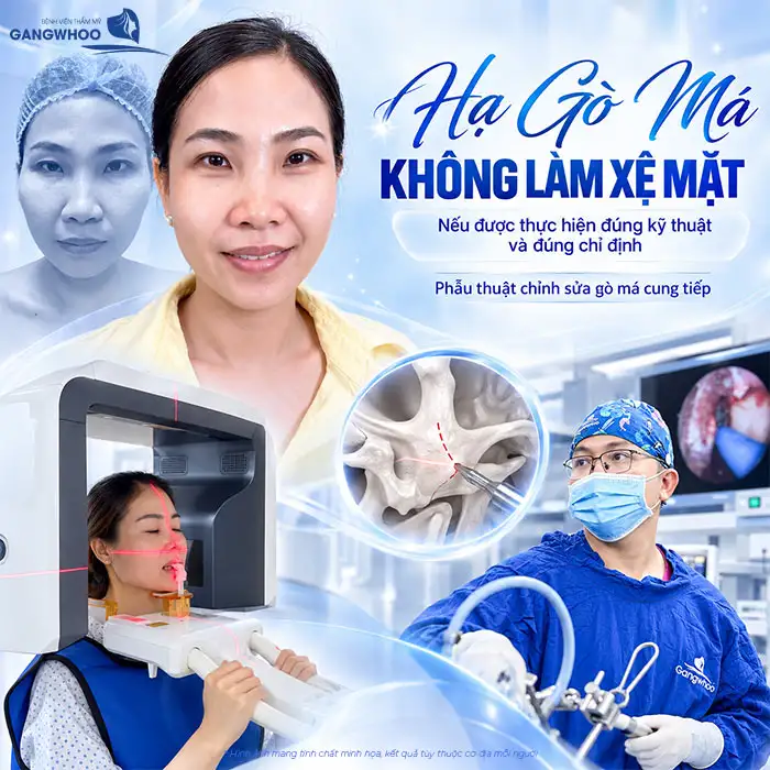 Hạ Gò Má Có Bị Xệ Mặt Không? Chuyên Gia Giải Đáp