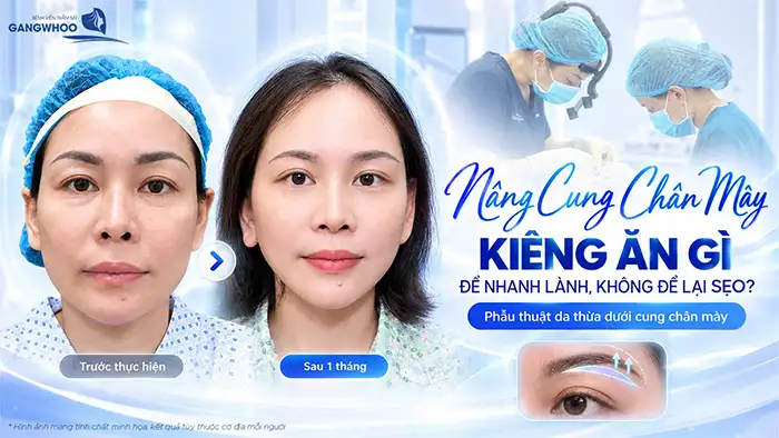 Nâng Cung Chân Mày Kiêng Ăn Gì Để Nhanh Lành, Không Để Lại Sẹo?